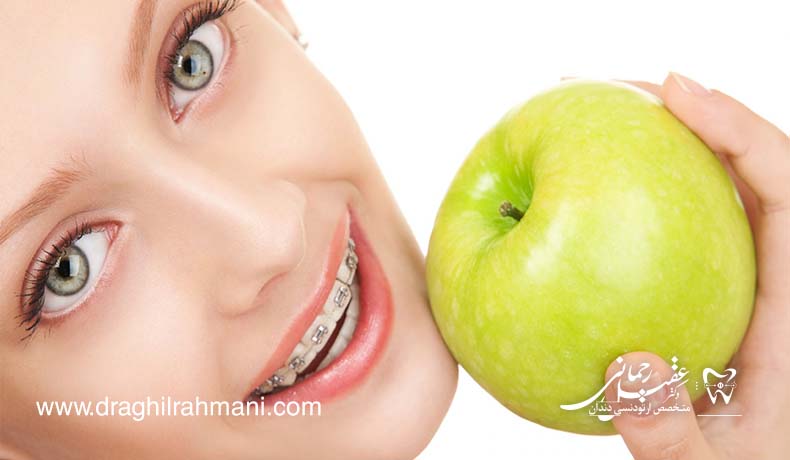 انواع بریس انواع بریس