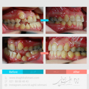 ارتودنسی دکتر رحمانی