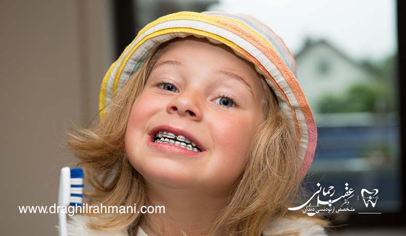 ارتودنسی پیشگیری ارتودنسی پیشگیری